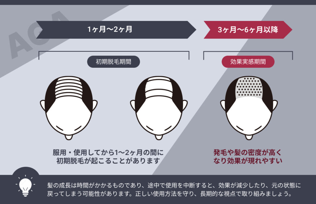 ミノキシジルの効果実感