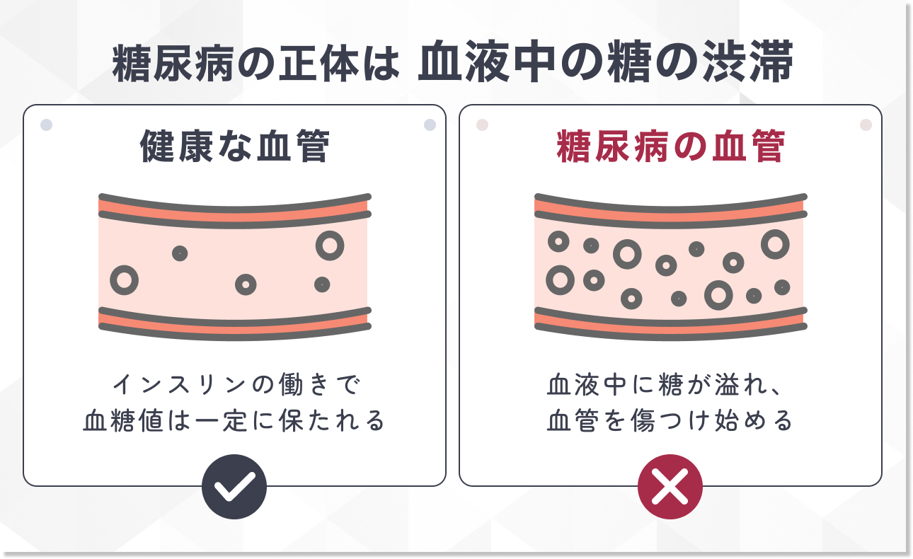 そもそも糖尿病とは？